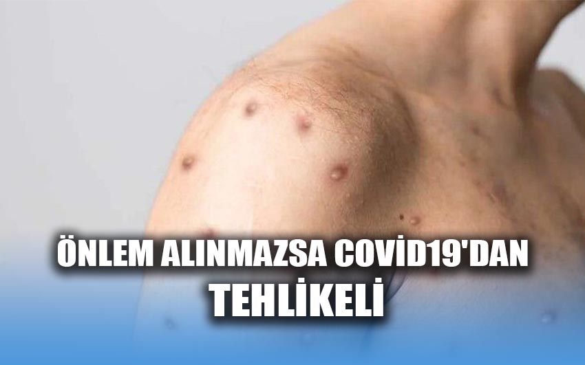 Önlem alınmazsa covid19'dan tehlikeli